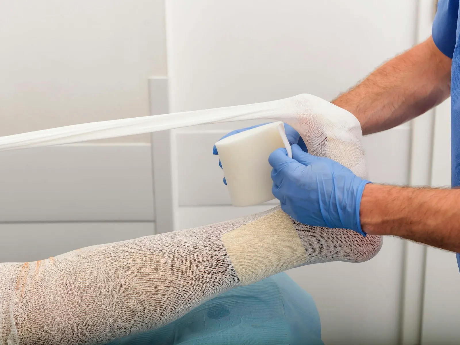 A clinician applying a compression dressing to a patient's leg